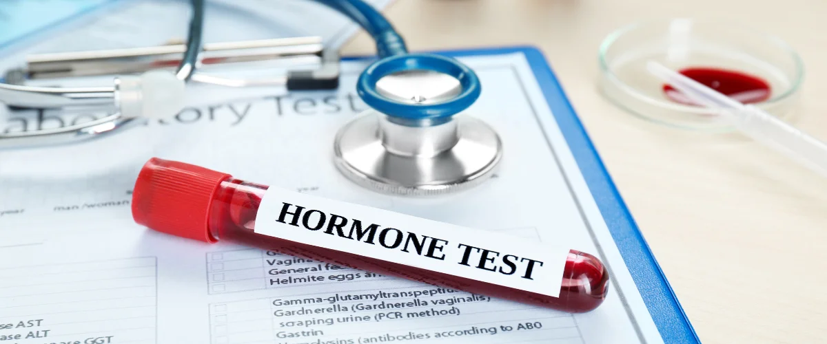 Blood sample tube labeled hormone test on medical laboratory paperwork Blood sample tube labeled hormone test on medical laboratory paperwork