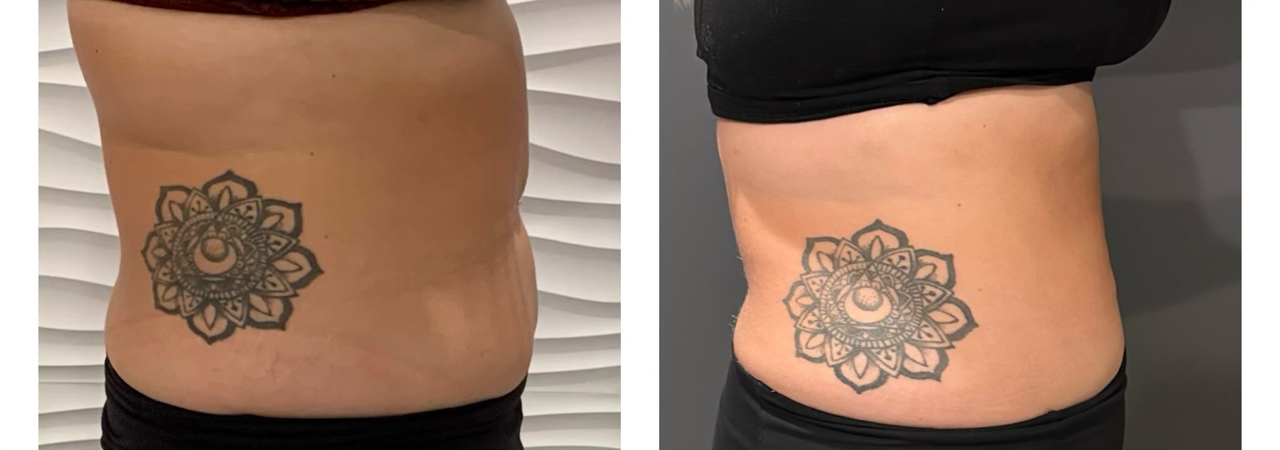 KAYLEE progress pic