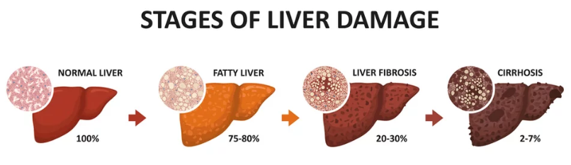 liver liver
