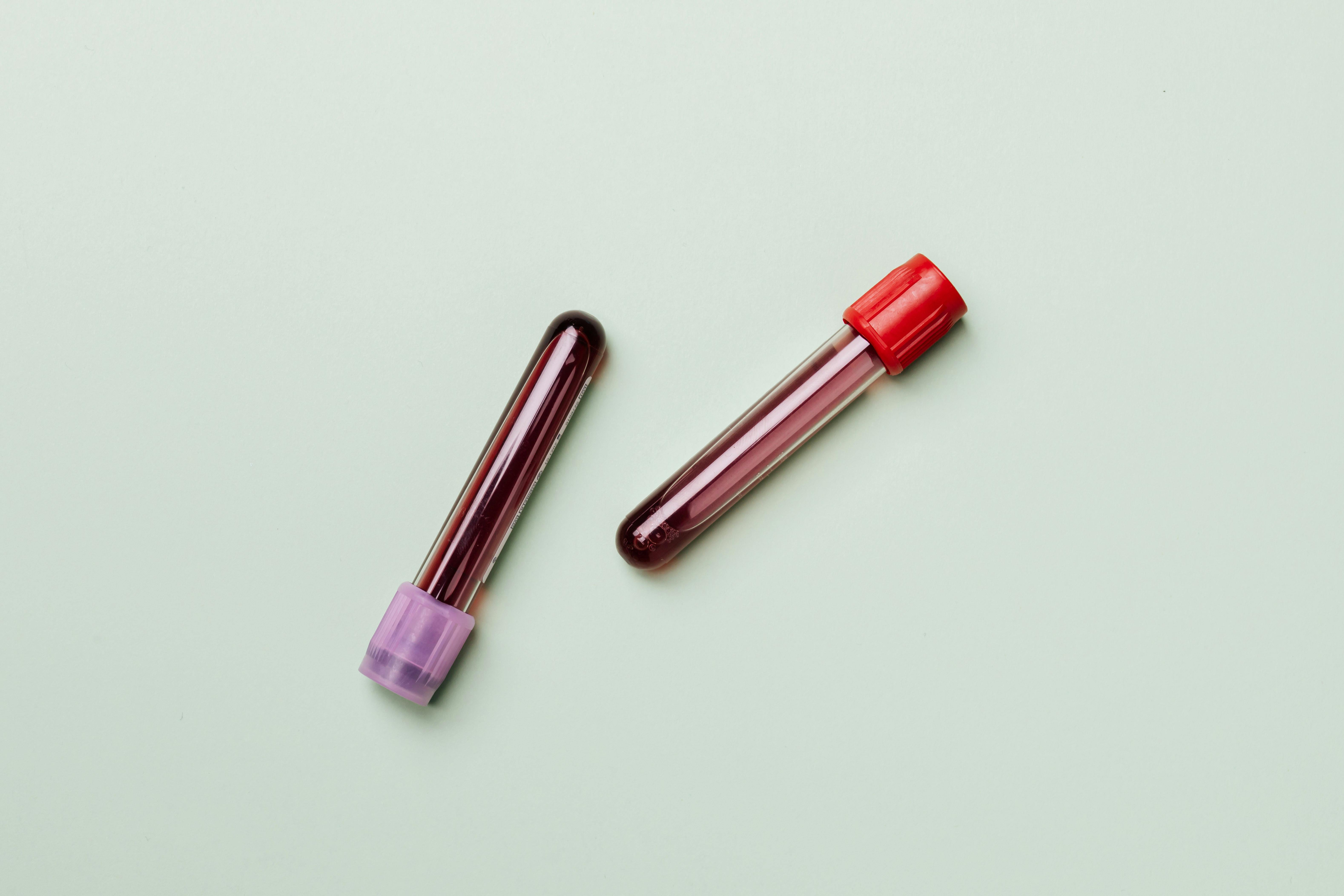Thyroid Testing