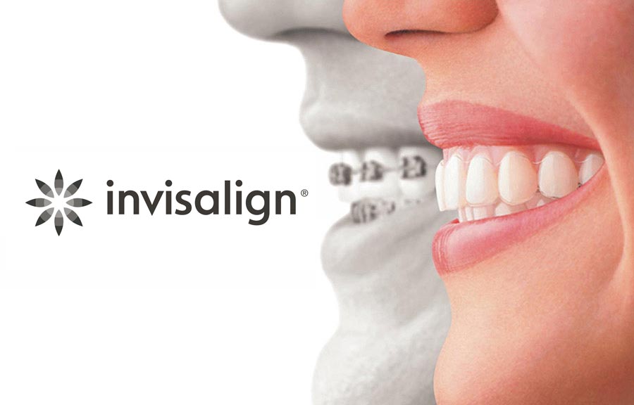 Discreet and Virtually Invisible