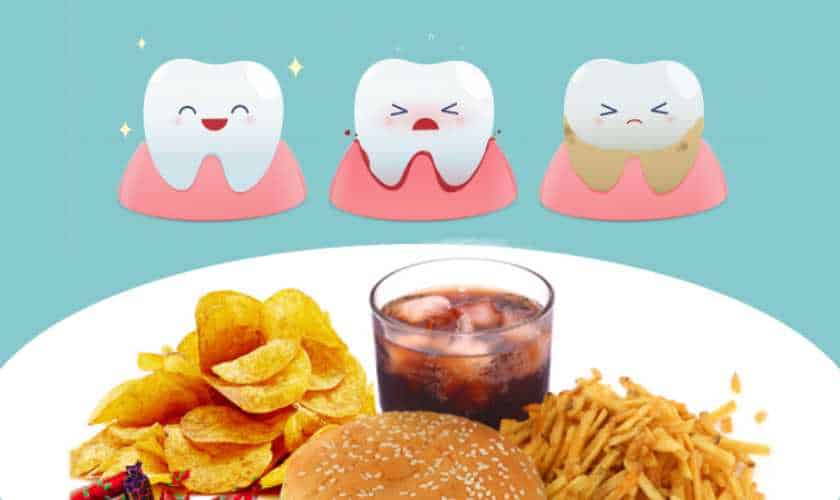 Foods to Avoid for Better Dental Health