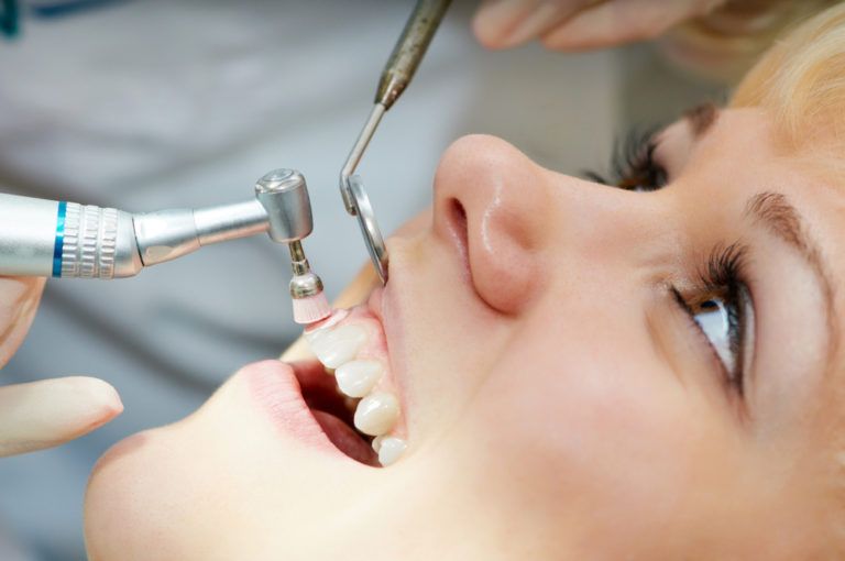 The Importance of Professional Teeth Cleaning