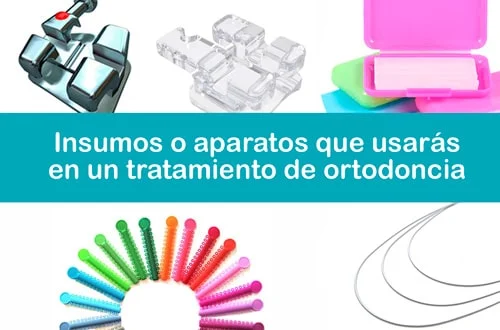 Conoce algunos de los insumos o aparatos que pueden aparecer en un tratamiento de ortodoncia.