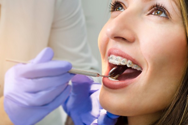 Important Questions to Ask Your Child’s Orthodontist