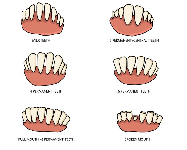 an illustration of the stages of teeth in goats an illustration of the stages of teeth in goats