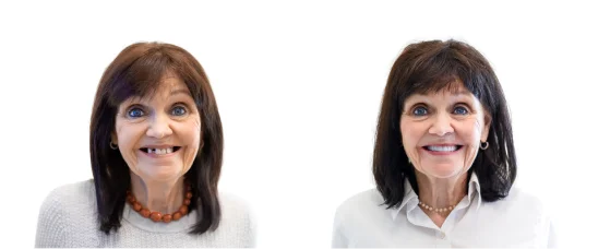 Patient Before After Image
