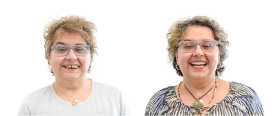 Patient Before After Image