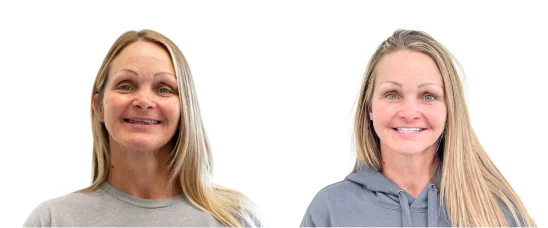 Patient Before After Image