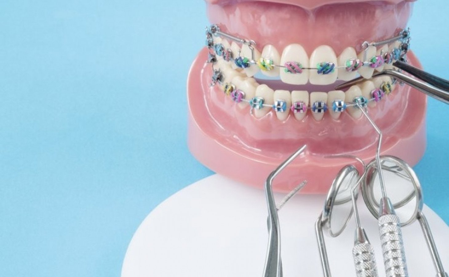 An image of a model of teeth with braces as a teaching mechinism An image of a model of teeth with braces as a teaching mechinism