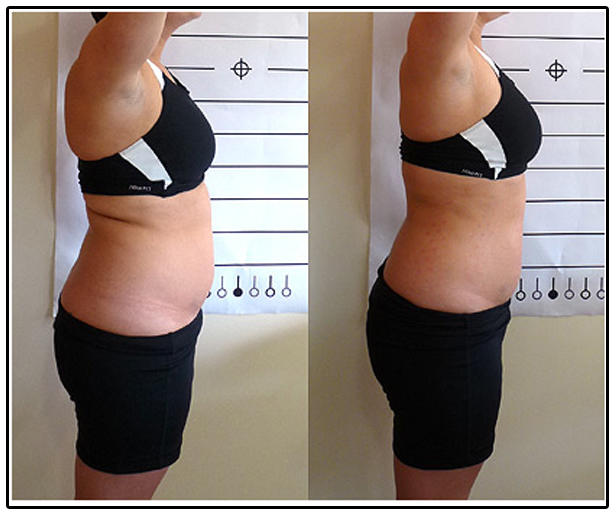 Abdomen Results
