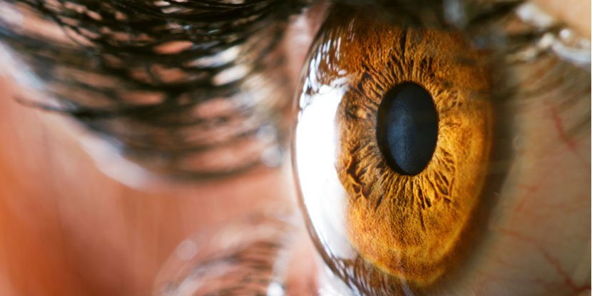 brown iris