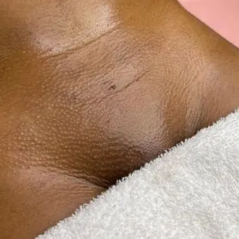 Classic Brazilian Wax