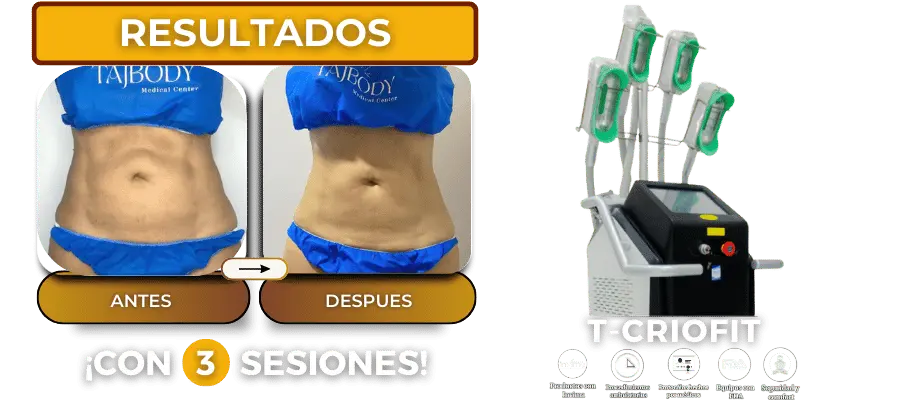 Resultados en pocas sesiones con Tajbody y criolipólisis