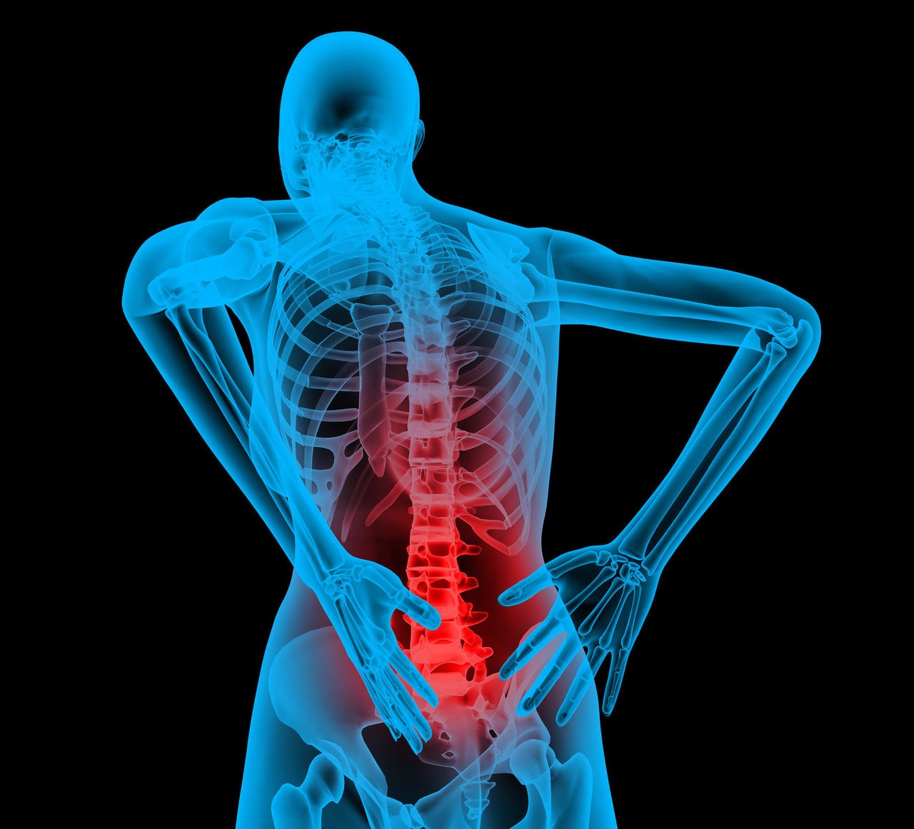 The Benefits of Combining Dry Needling and Core Training for Back Pain