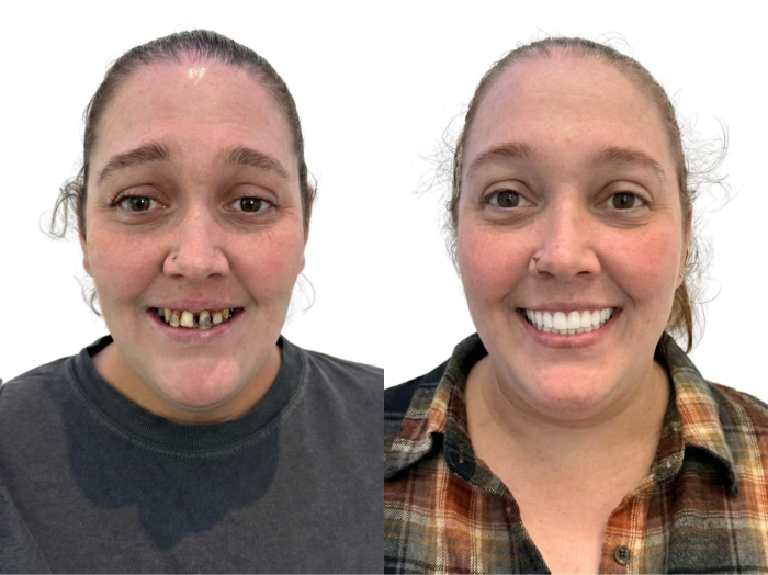 Before and After Image 6