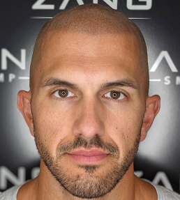 Men Hair Grow