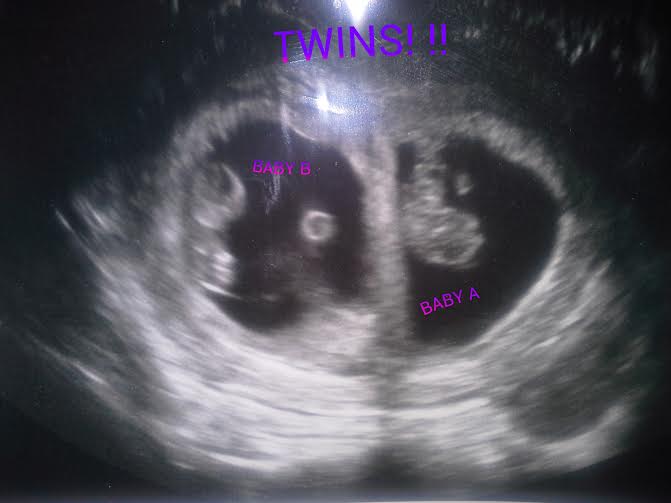 Twin pregnancy announcements, twin girls, twin mom
