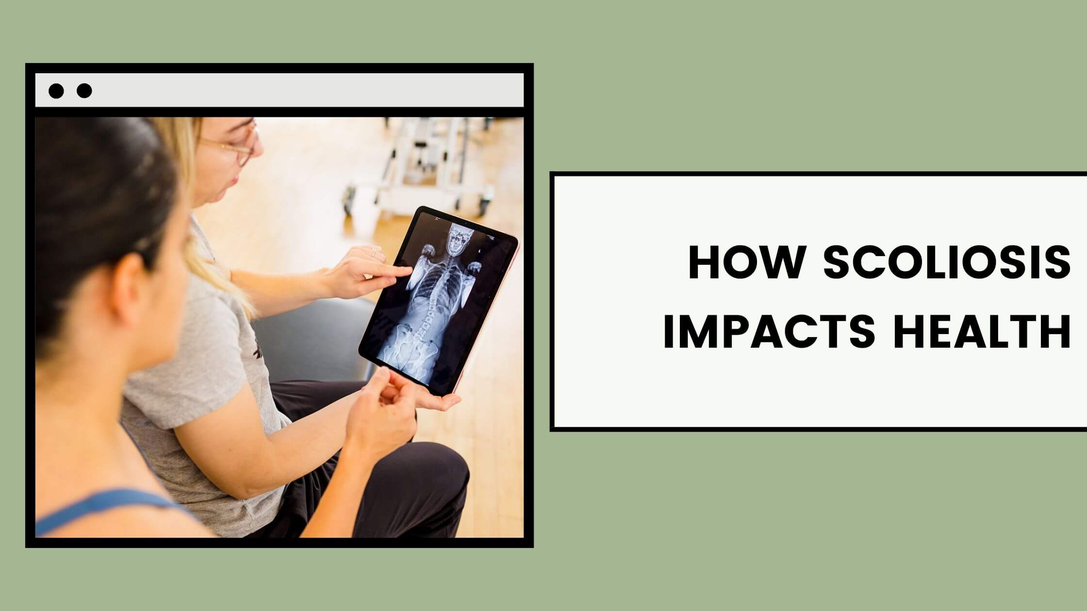How Scoliosis Impacts Health
