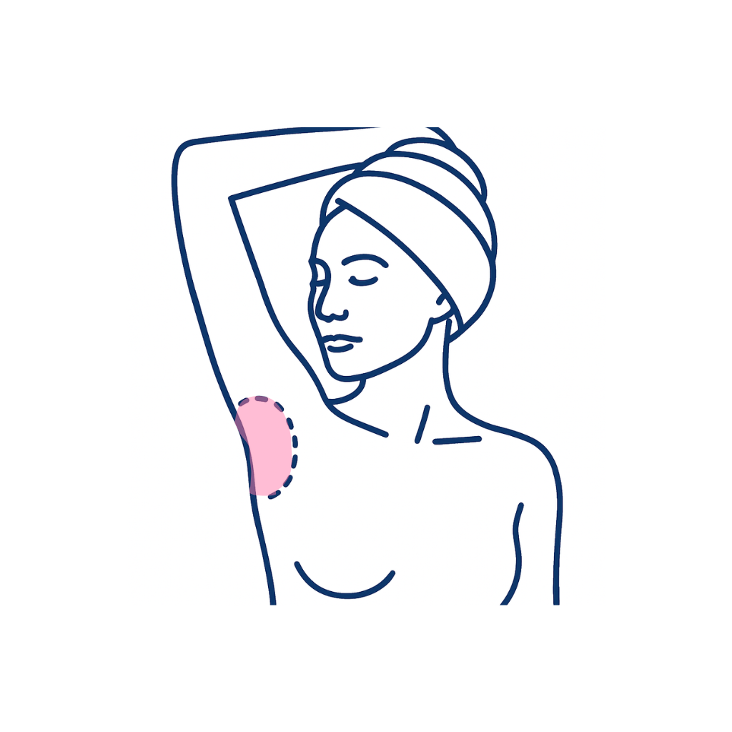 Underarms
