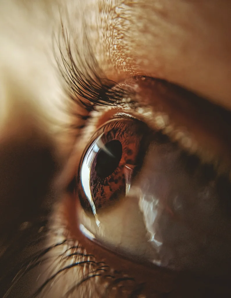Eye