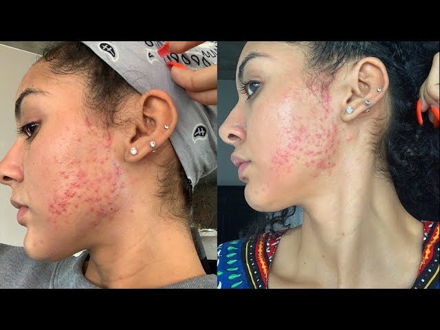 Esthetician blogs