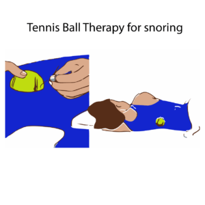 tennis ball therapy tennis ball therapy