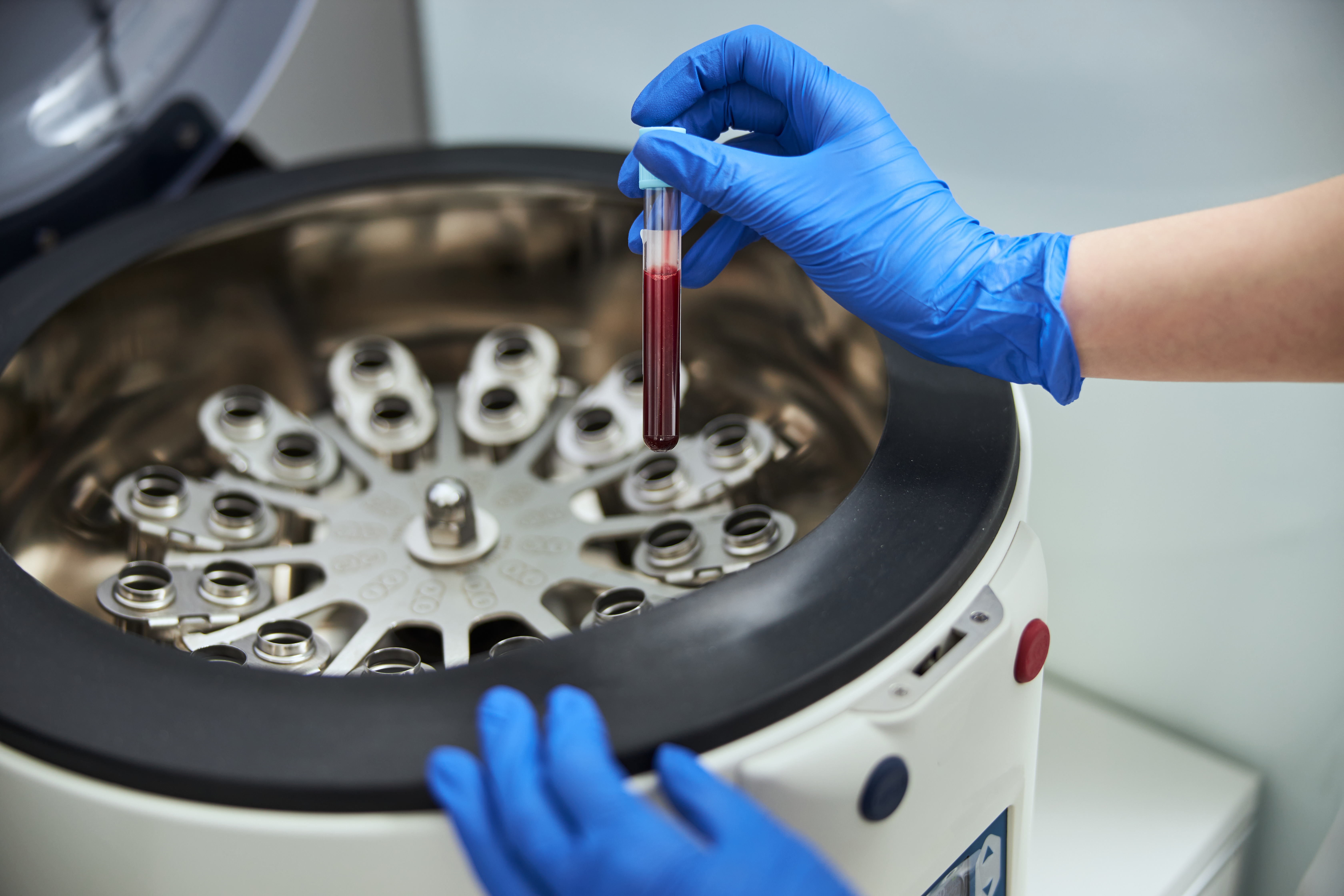 Understanding regenerative medicine Understanding regenerative medicine