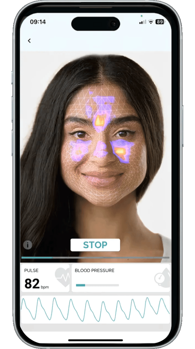 Step 2: Discover Insights