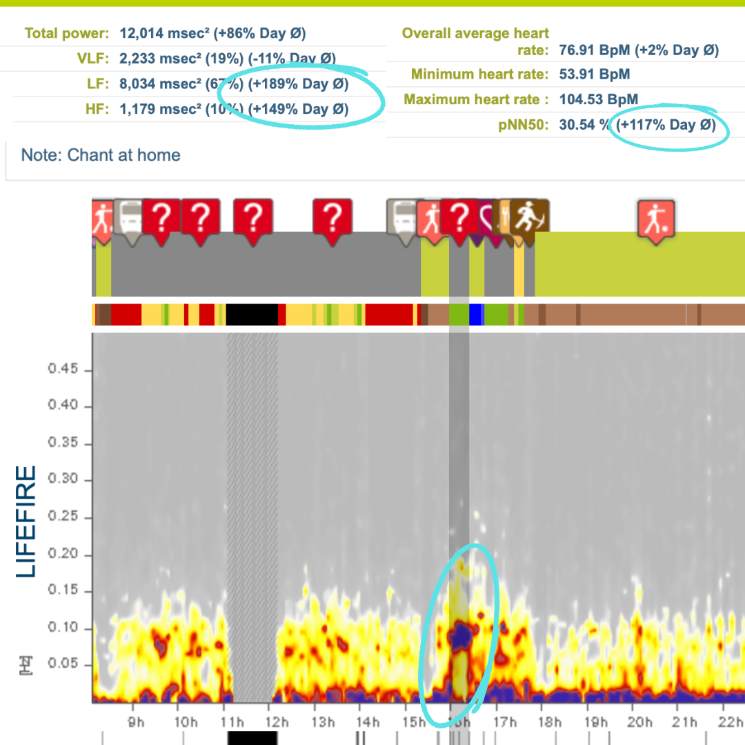 HRV analysis