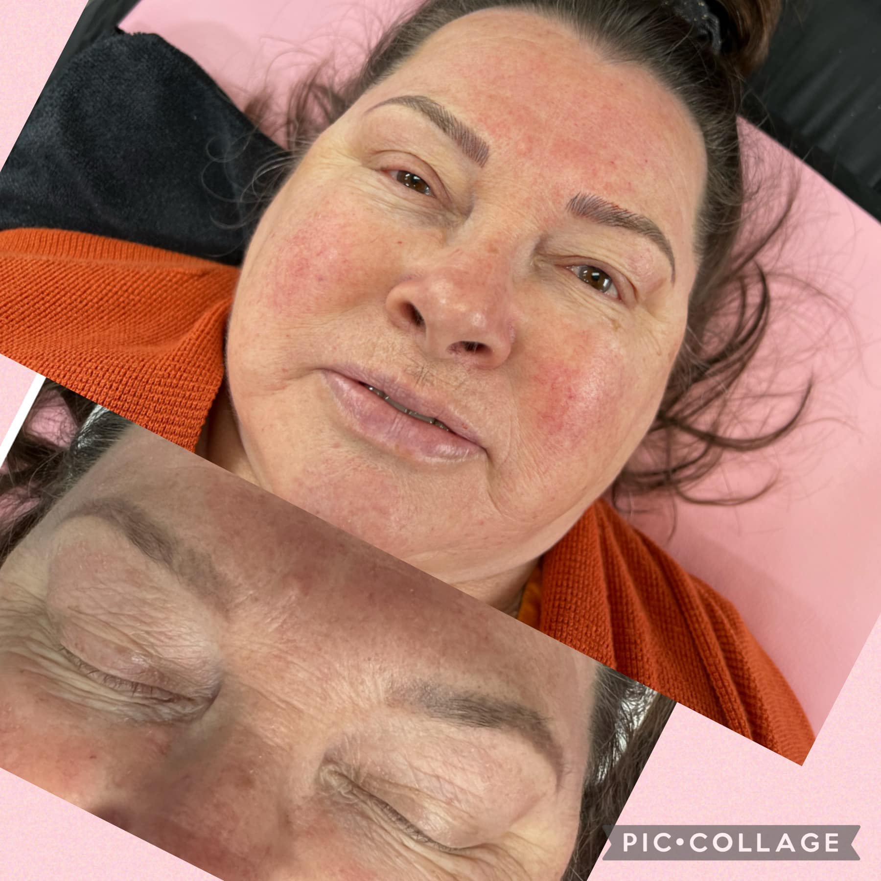 Eyeliner Tattooing Before & After