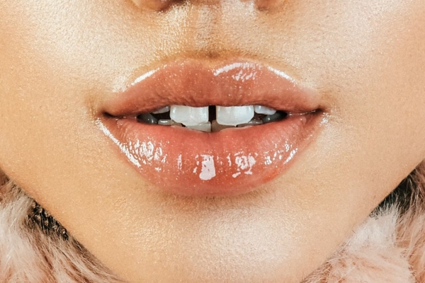 All About Lip Filler