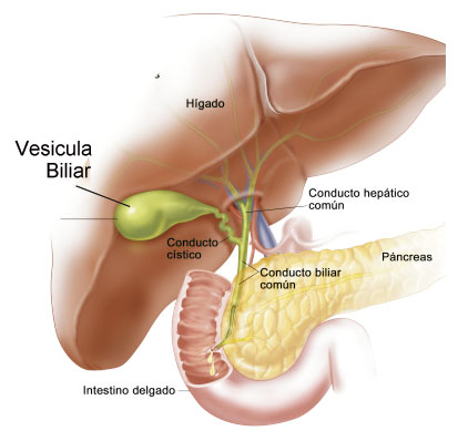 Imagen de Colecistectomía