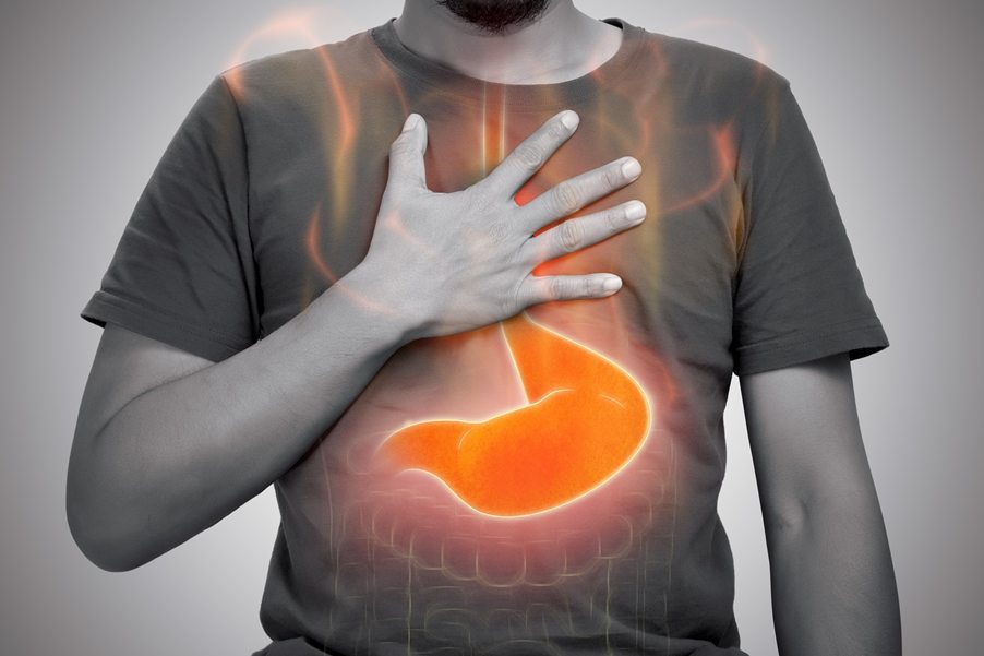 Endoscopy and GORD
