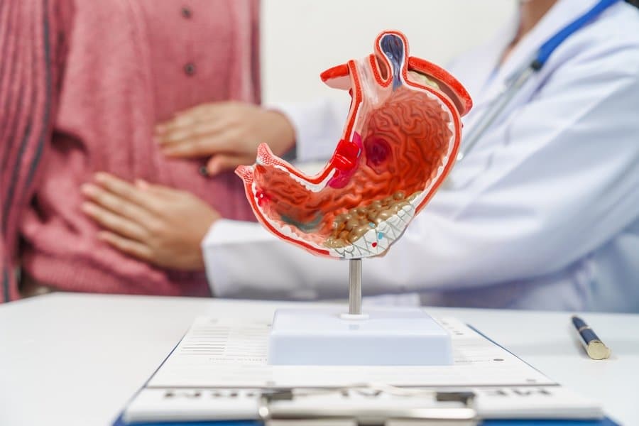 Lower Esophageal Sphincter