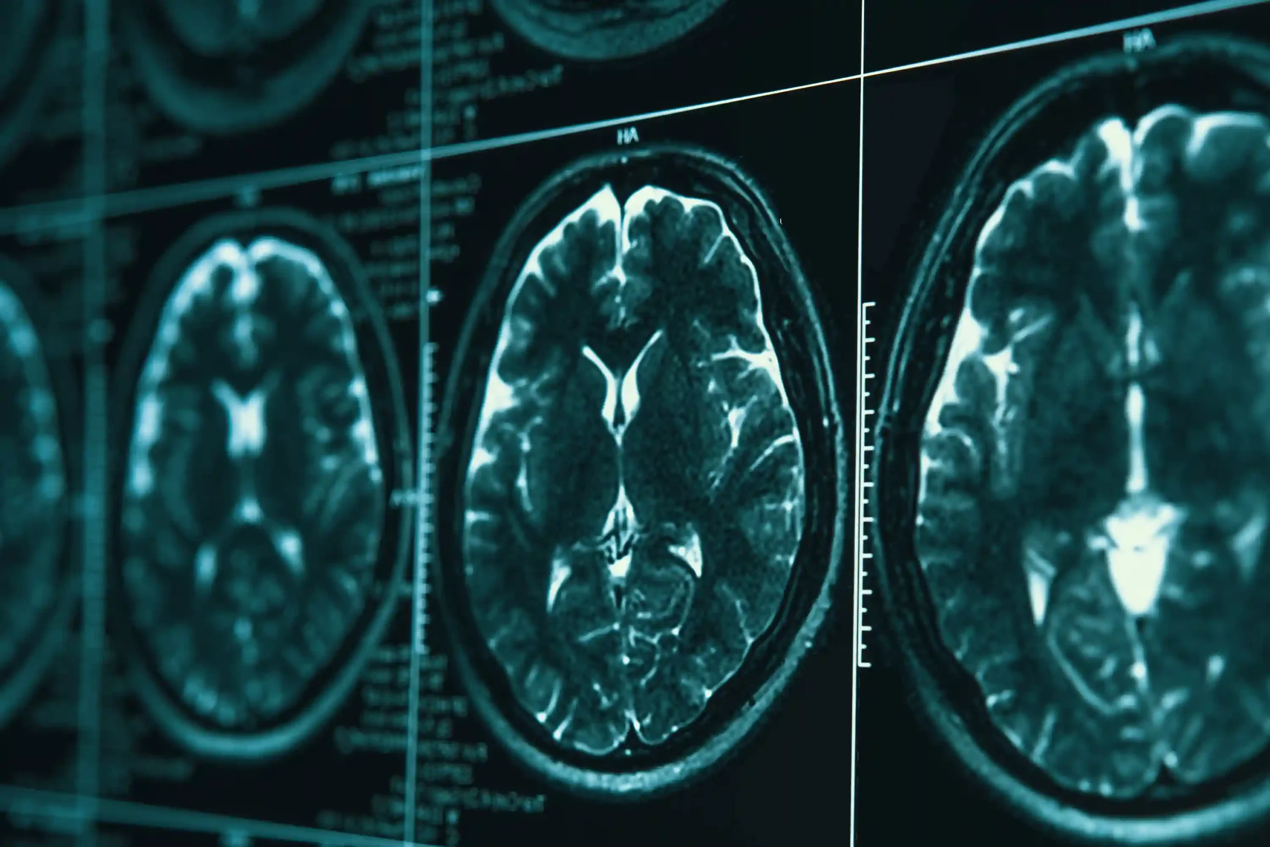 Brain scans images