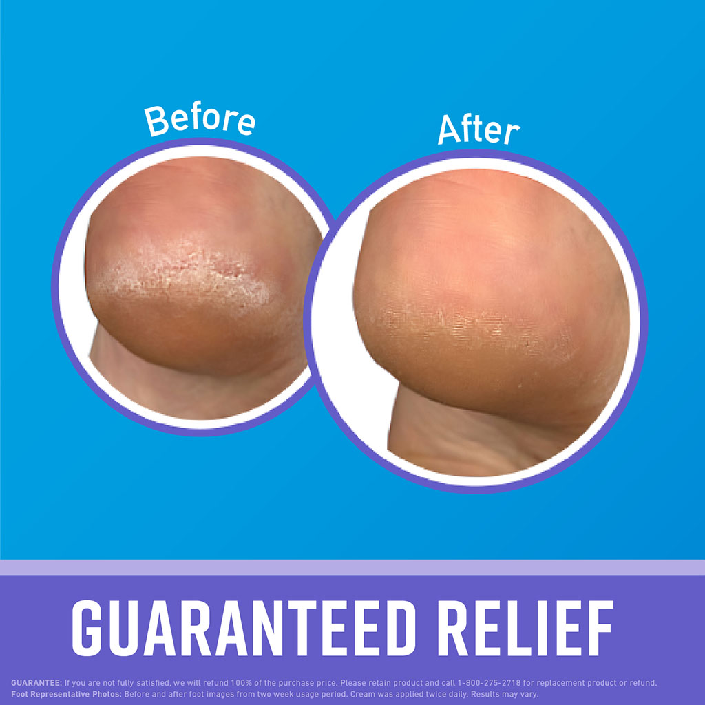 O'Keeffe's Healthy Feet Foot Night Treatment Cream Tube 89ml