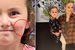 Összetört az anya, mert egy puszi miatt került kórházba a 4 éves kislánya