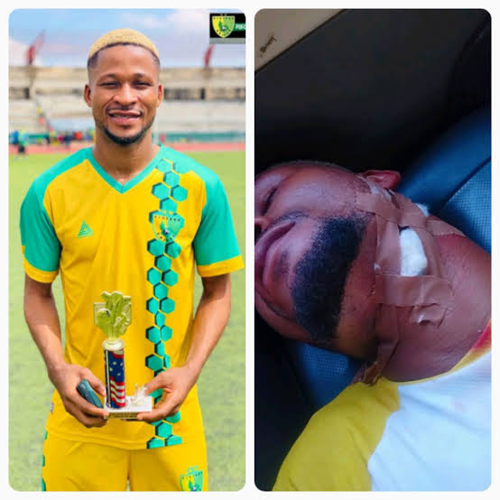 Man bags three months jail for attacking Plateau United player