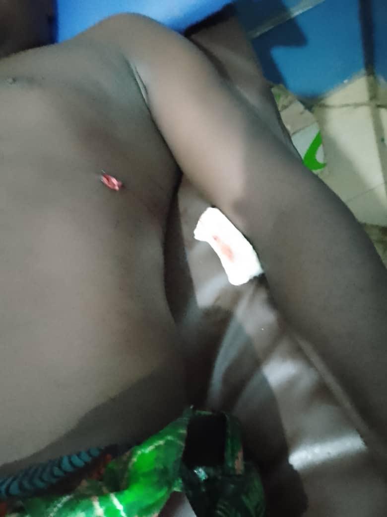 Gunmen attack NDLEA team in Abuja, three operatives shot - Image 2