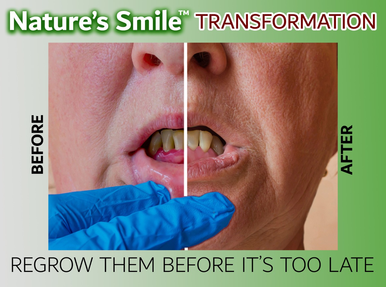 Regrow Your Gums Natures Smile