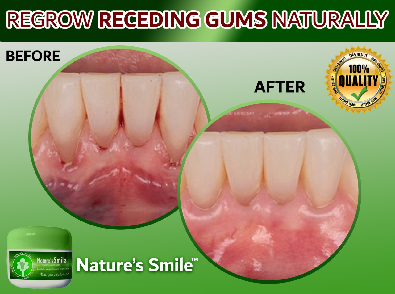 Natures Smile Discount