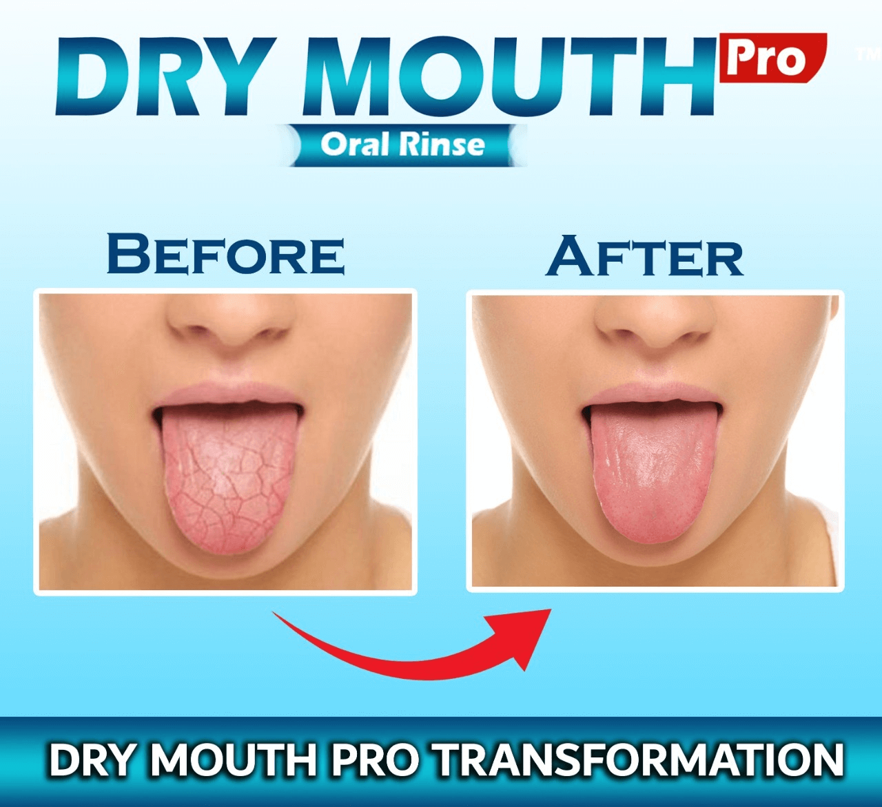 dry mouth relief natural