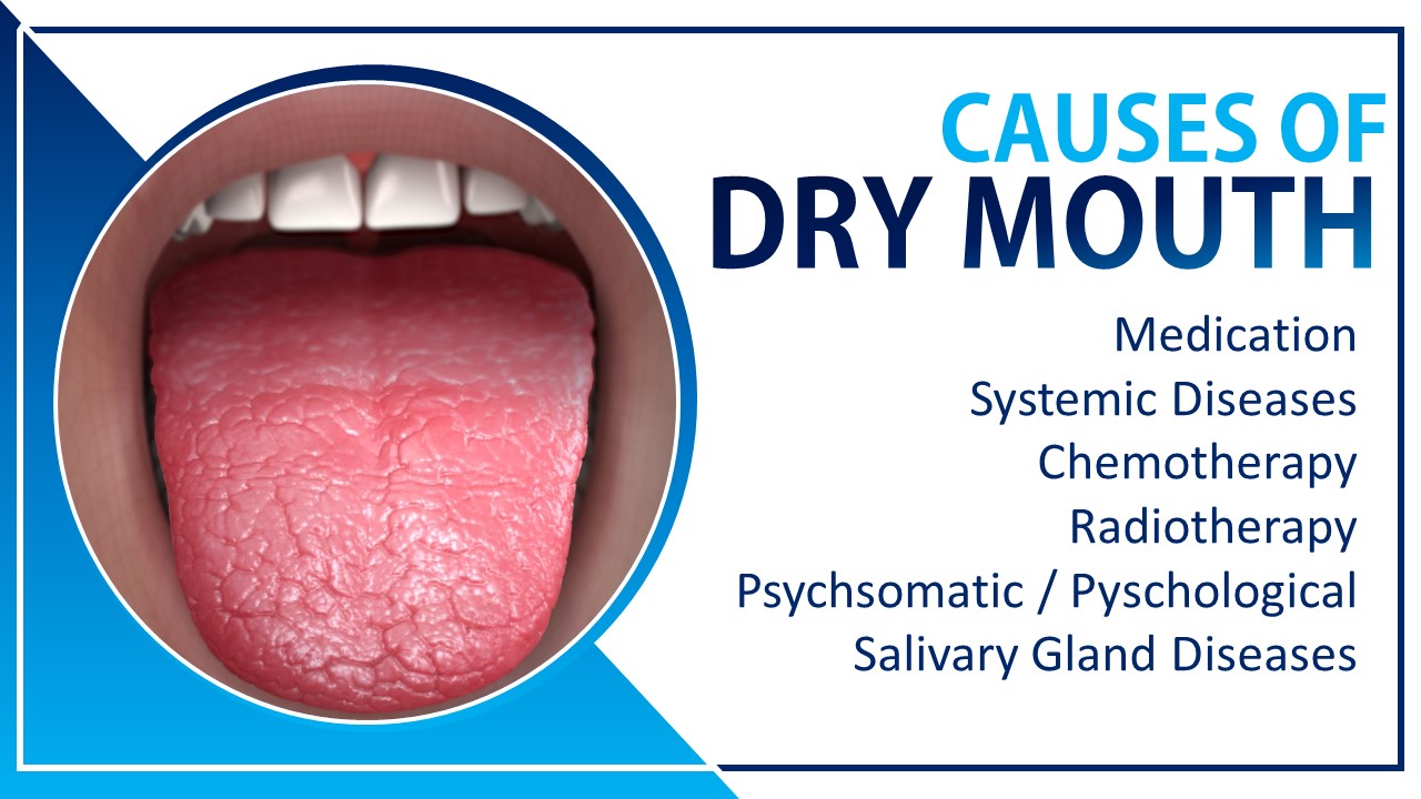 Mouthwash for Dry Mouth