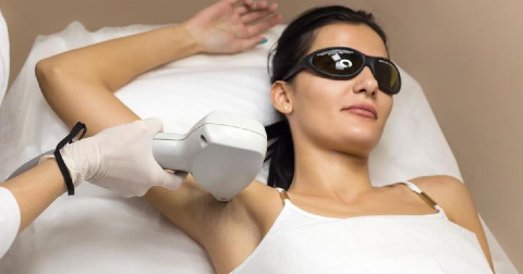 UNWANTED HAIR REMOVAL (DIODE LASER)