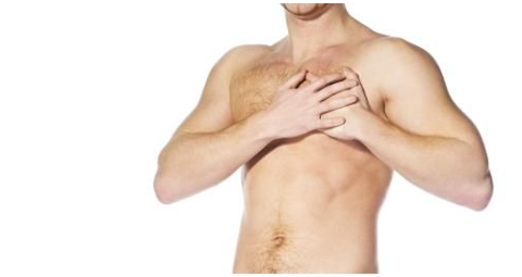 GYNAECOMASTIA SURGERY