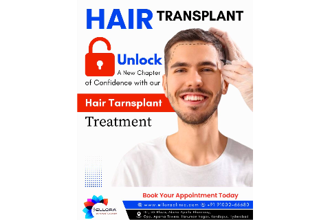 Hair Transplantation 