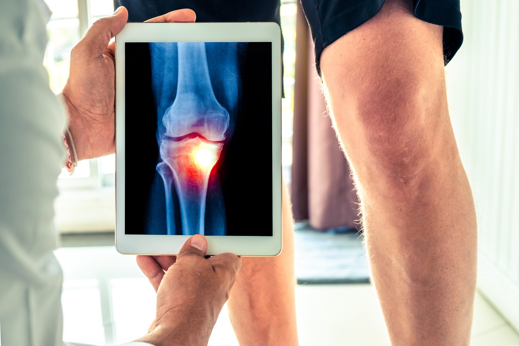 How to Find Top-Rated Rheumatologists Near You