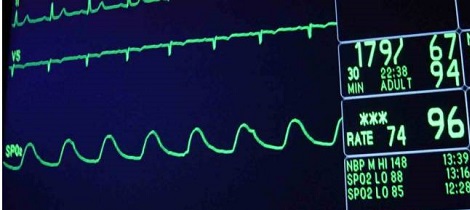 Cirurgia cardíaca paralisada por varredura de antivírus