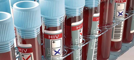 SUS vai incorporar remédio para prevenir infecção por HIV